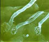 Candida unter dem Mikroskop